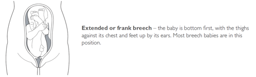 what breech presentation means